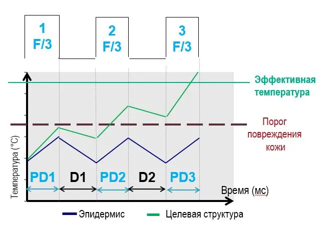 Технология MSP
